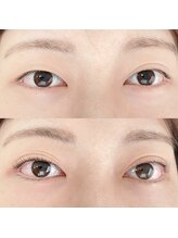 ウチニィ(uchiny)/30分まつげパーマ