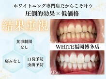 ホワイト 福岡博多店(WHITE)