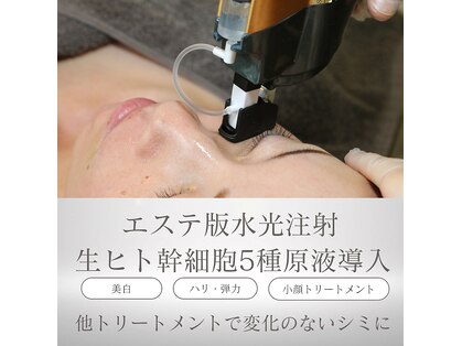 エステティック モンルーチェ(Esthetique monluce)の写真