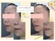 フェイシャルサロン ルイーズ アイの写真