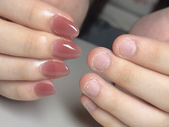 パズルリングネイル(Puzzle.ring Nail)の写真/深爪から、輝く指先へ。あなたの変化を実感。