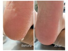 エヌ(enu.)/足裏角質ケア