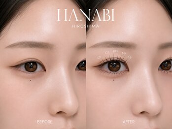 ハナビ ナミキ(HANABI NAMIKI)/スーパーフラットラッシュ100本