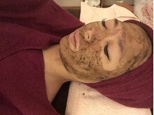 アリス(alice)/ハーブピーリング