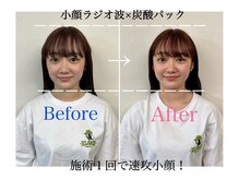 ナゴミ鍼灸 整体院(NAGOMI鍼灸 整体院)