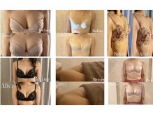 レーヴ(Reve)/バストアップ/下垂/バストケア