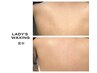 【女性】Wax脱毛（腕全体/足全体/背中全体/顔全体）いずれか１箇所