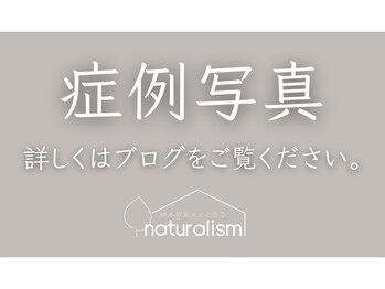 ナチュラリズム/