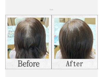 アンドゥ(Undo)/後ろ姿に自信！つむじ割れ解消！