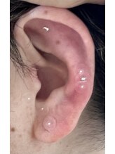 ファイン(fine)/耳つぼジュエリー