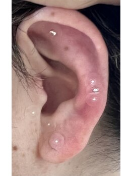 ファイン(fine)/耳つぼジュエリー