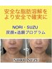 7月限定【戻顏×造顔】小顔矯正×部分脂肪分解/レモンボトル3CC/120分￥38000