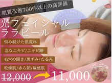 チャパン(Chapan)
