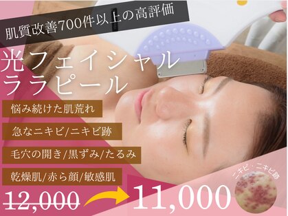 チャパン(Chapan)の写真