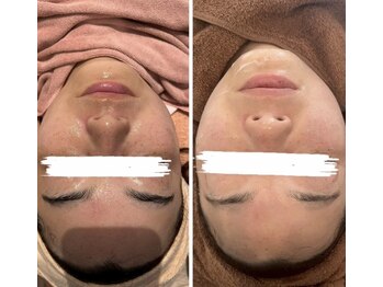 エムフルール リラク&エステ【吹田市】/