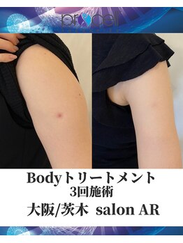 メンズサロンアール(AR)/プロセルセラピーズ