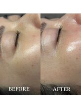 オンフリーク(ON FLEEK)/シワのない艶肌を育てる