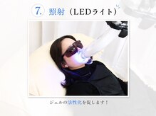 ホワイト 福岡天神店(WHITE)/7.照射