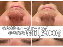 イデアルミー 大宮店(イデアルMe)の雰囲気（毛穴レス美肌・小顔・ハーブピーリングお任せください(^^)♪）