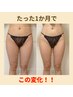 【6/30まで】『本気で痩せたい方必見★』頑固なセル脂肪撃退！モニター¥5,500