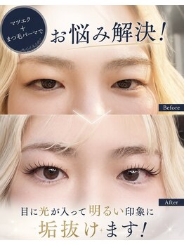 リリアン アイラッシュ(Liliane eyelash)の写真/下がりまつげ・逆さまつげでお悩みの方へ