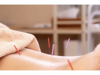 浅間口はりきゅう院の写真/<溜まった腰のつらさにアプローチ!>鍼灸で内側から健やかさを目指すケアで毎日を軽やかに♪