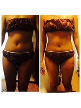 エンドリングフェイシャル専門サロン ムーンティア/インディバ痩身一回でスッキリ！