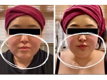 ルナグランデ(Luna grande.)/効果写真