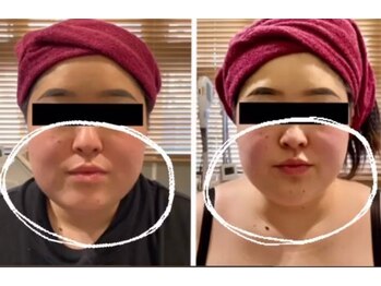 ルナグランデ(Luna grande.)/効果写真