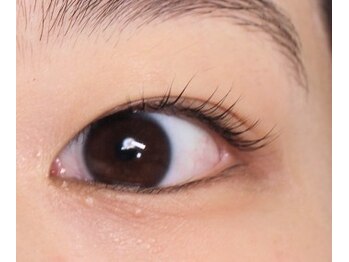 チェリーアイ(cherry eye)/まつ毛パーマ・まつげカール