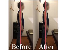 カワル整体 上通り院/両足がしびれて仕事が辛いです…