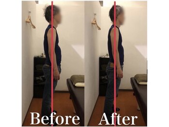 カワル整体 上通り院/両足がしびれて仕事が辛いです…