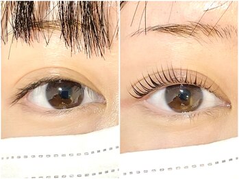 ジューシーアイ 志木店(Juicy Eye)/驚きのビフォーアフター