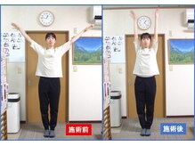 ひらばり ハッピー整体/腕が上がらない肩こりも楽々