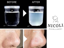 ニコリ(NICOLI)/結果にこだわっています