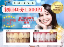 ホワイトニングショップ 福岡春日店