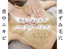 レリール バイ エレクトロ(Rerire by electro)の雰囲気（ハーブピーリングで黒ずみ毛穴やニキビ予防も！肌トーンアップ〇）