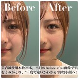 ナノフェイス 名古屋駅前店(nano face)