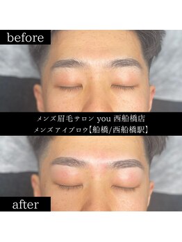 ユー 西船橋店(you)/ビフォーアフター写真