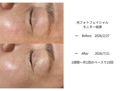ミガキヤ(MIGAKIYA)の写真