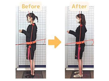 藤接骨院 焼津小川院/首、肩、腰の痛み、生理不調改善