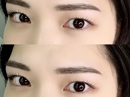 エコール(EcorE)の写真