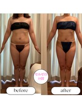 キュール(KuhL)/30代痩身ビフォーアフター☆