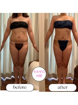 キュール(KuhL)/30代痩身ビフォーアフター☆