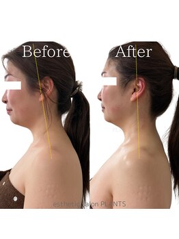 プランツ(PLANTS)/30代／１回／姿勢改善