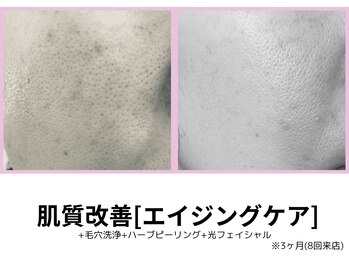 シェリール(Cherir)/肌質改善