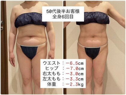 クラヴェル(Clavel)の写真