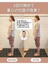 スペックフィジカルコンディショニング(SPECフィジカルコンディショニング)/40代女性/姿勢ビフォーアフター