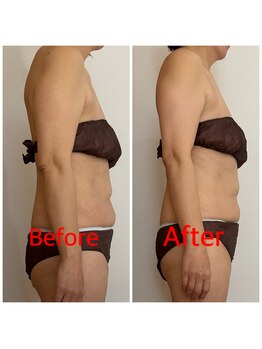 アイナ(Aina)/肩こり改善＆美姿勢