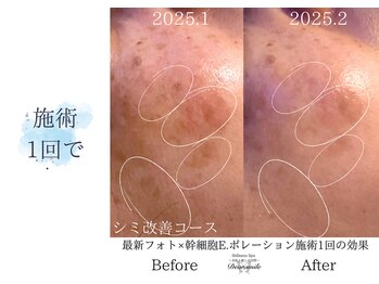 ディアスマイル(Dear.smile)/施術1回で